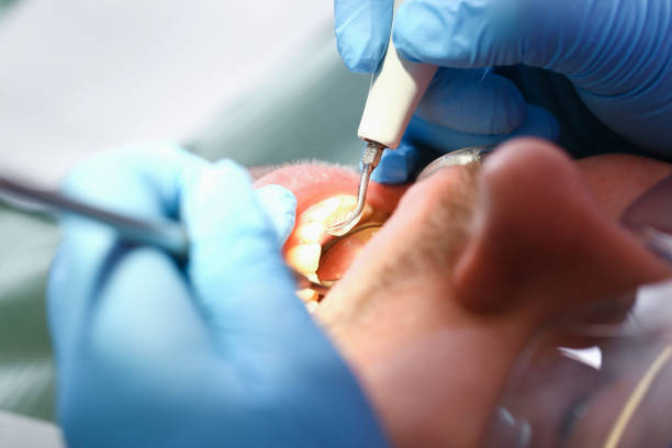 Best Emergency Dental Surgery in Ridgemark, CA