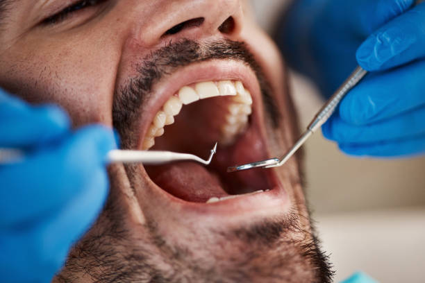 Best Pediatric Emergency Dentist in Ridgemark, CA