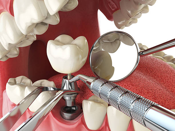 Best Walk-In Emergency Dentist in Ridgemark, CA