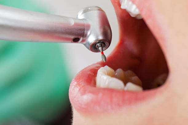 Best Emergency Treatment for Toothache in Ridgemark, CA
